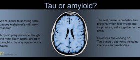 Maybe Alzheimer's Isn't Inflammatory, So What Is To Blame?