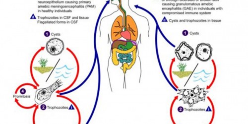 Amoebic Meningoencephalitis: Who Gets Infected?