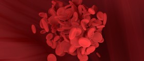 Болезнь аорты: 4 осложнения аневризмы аорты
