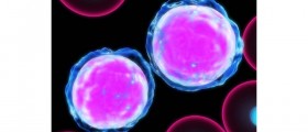 Aplastic Anemia and MDS: Causes, Symptoms, Treatment