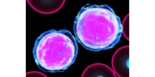 Aplastic Anemia and MDS: Causes, Symptoms, Treatment