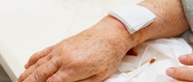 Arthritis and Your Skin: 6 Ways RA Affects Skin Problems