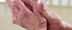 Controlling and Managing Arthritis