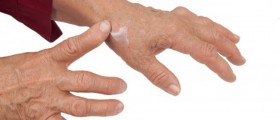Managing The Pain Of Rheumatoid Arthritis