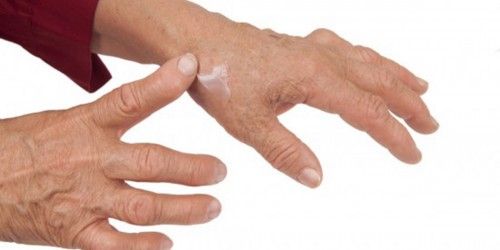 Managing The Pain Of Rheumatoid Arthritis