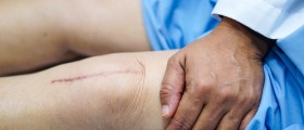 Arthritis Treatment: 4 Things You Should Know About Different Types Of Knee Replacement Surgery