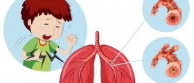 What Is Asthma?