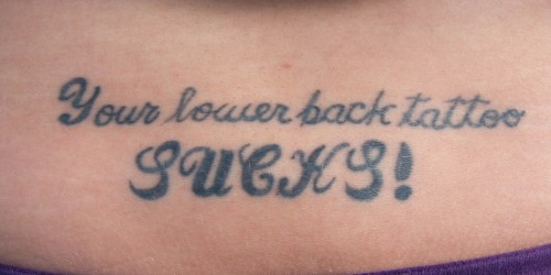 Want To Get Rid Of That Awful Tattoo?