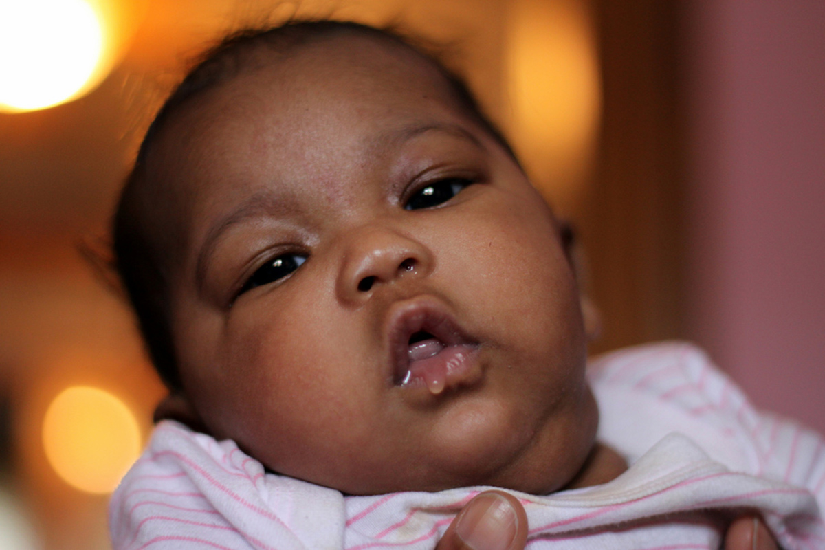 Complications Of RSV Can Be Serious | Children's &amp; Teens Health