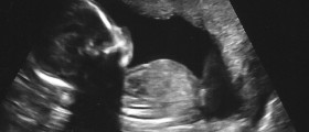 What To Expect From Your First Ultrasound During Pregnancy