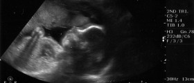 Babies practice crying in the uterus!