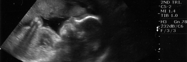 Babies practice crying in the uterus!