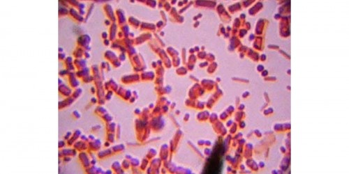 Superbug Clostridium Difficile About to Overtake MRSA in Hospitals