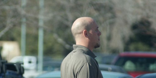 Hair Transplants For Men In Their 20s - What Do The Experts Say?