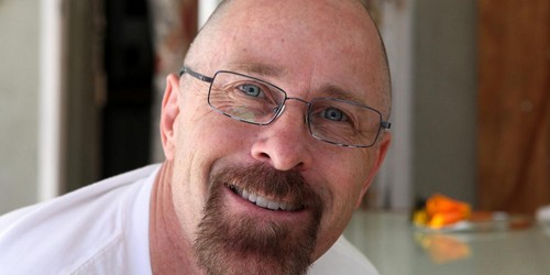 Going Bald? Hair Regrowth Options For Men With Male Pattern Baldness