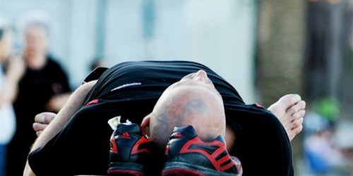 Treatment of Baldness: The Cure for Hair Loss Accidentally Found