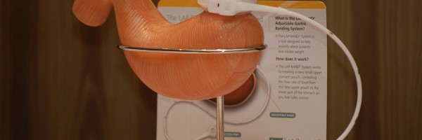 Bariatric Surgery Should Not Be The Last Resort