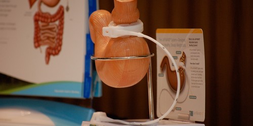 Best Mobile Apps to Use Before and After Bariatric (Weight Loss) Surgery