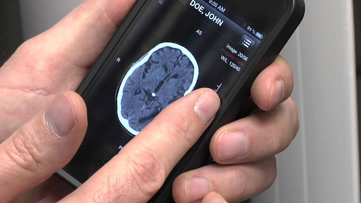 Best Medical Apps for Stroke Prevention, Diagnosis and Treatment | Apps for  Healthcare Professionals articles | Medical Apps center | SteadyHealth.com