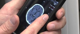 Best Medical Apps for Stroke Prevention, Diagnosis and Treatment