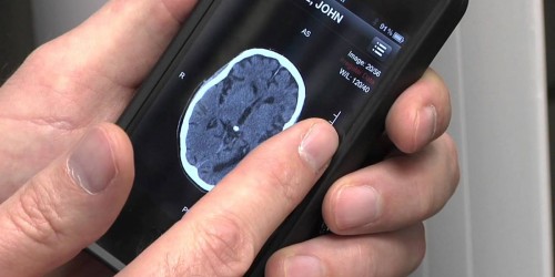 Best Medical Apps for Stroke Prevention, Diagnosis and Treatment
