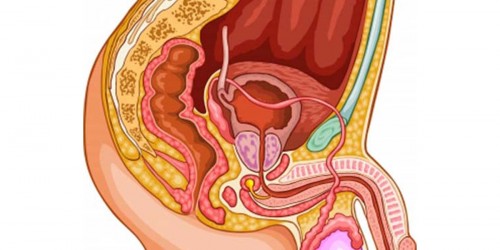 Prostate Enlargement: Benign Prostatic Hyperplasia (BPH) Symptoms and Treatment