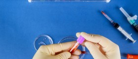 Blood Cancer Awareness Month: Leukemia and Lymphoma Manifestations On Your Organs And Tissues