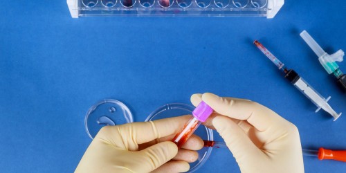 Blood Cancer Awareness Month: Leukemia and Lymphoma Manifestations On Your Organs And Tissues