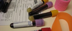 Could You Be Anemic? Symptoms Of Anemia In Women