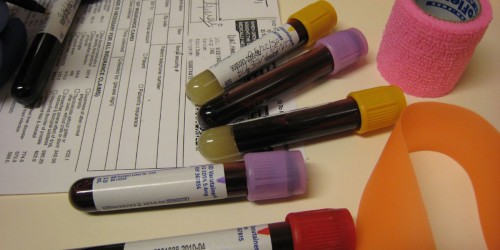 Could You Be Anemic? Symptoms Of Anemia In Women