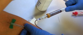 Aging And The Mystery Of "Young Blood"