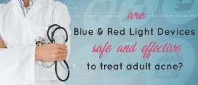 Blue And Red Light Devices To Treat Adult Acne: Are They Safe And Effective?