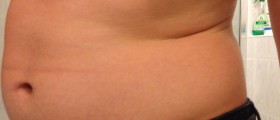 10 Tremendously Unexpected Causes Of Sudden Weight Gain