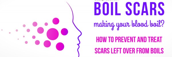 Boil Scars Making Your Blood Boil? How To Prevent And Treat Scars Left Over From Boils