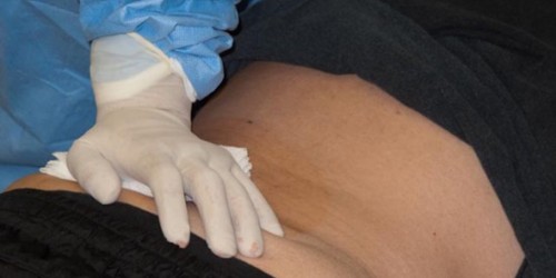 Bone Cancer Treatments, Symptoms, Risks and Prevention Tips