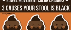 Bowel Movement Color Changes: 3 Causes Your Stool Is Black