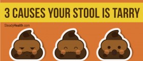 Bowel Movement Color Changes: 3 Causes Your Stool Is Tarry