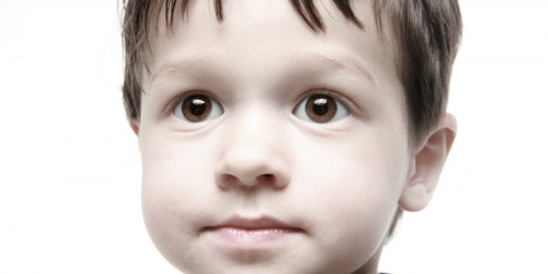 How Family Snapshots Can Save Lives: Eye Cancer In Pictures