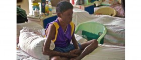 Leprosy - Unfinished Story