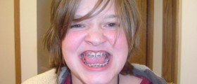 When Orthodontic Is Treatment More Than Just Cosmetic: Braces For Medical Reasons