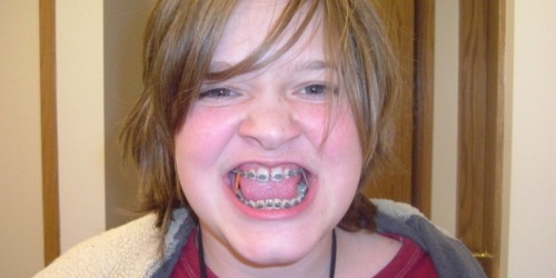 When Orthodontic Is Treatment More Than Just Cosmetic: Braces For Medical Reasons