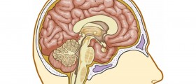 Mini Stroke - Signs and Symptoms in Women