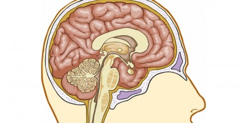 Mini Stroke - Signs and Symptoms in Women