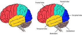 Brainstem lesions