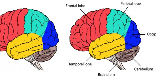 Brainstem lesions