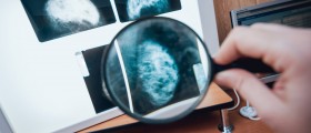 Breast Cancer Awareness Month: What You Need To Know About Screening Diagnostics Beyond Mammography