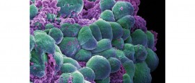 More Than 50% Of Women Affected By Lumpy Breasts Or Fibrocystic Breast Condition