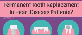 Bridges, Crowns, And Implants: Permanent Tooth Replacement In Heart Disease Patients