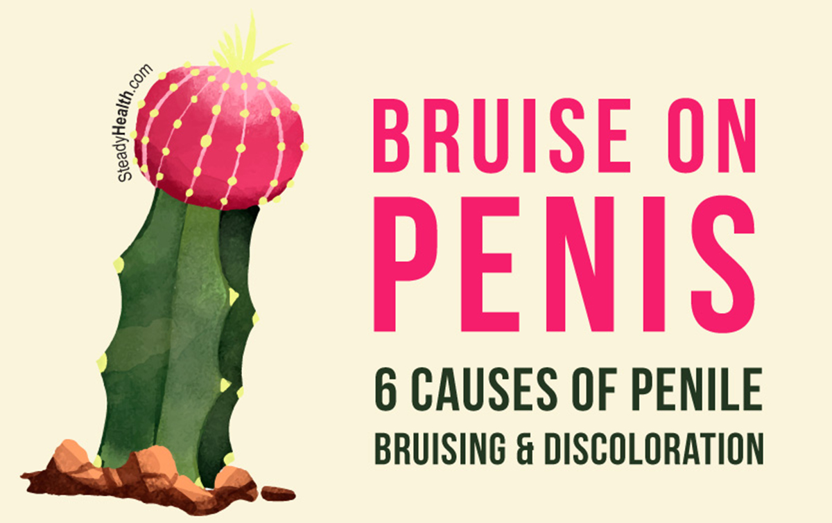 bruise-on-penis-6-causes-of-penile-bruising-and-discoloration-men-s