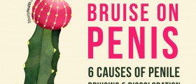 Bruise On Penis: 6 Causes Of Penile Bruising And Discoloration
